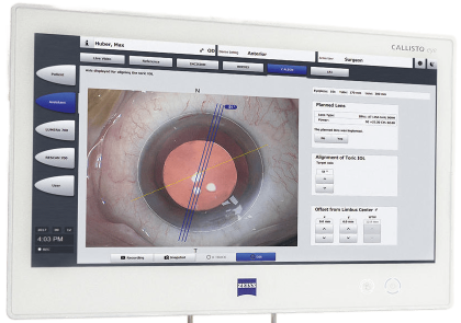 callisto-eye-from-zeiss-gradient-transformed